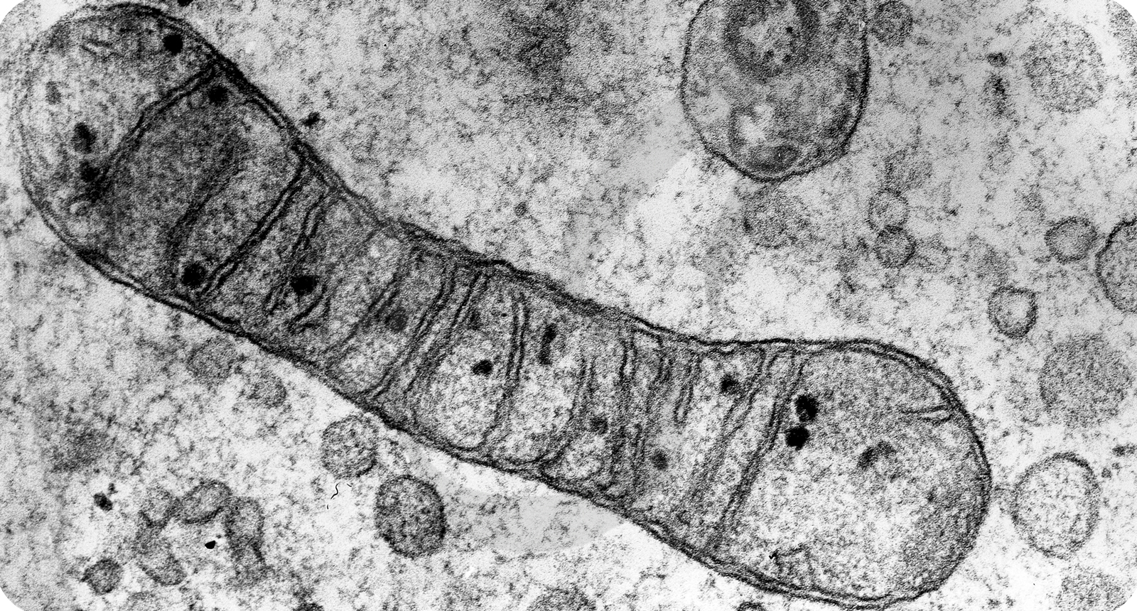 Просвечивающая электронная микрофотография митохондрии в клетке эмбриона цыпленка